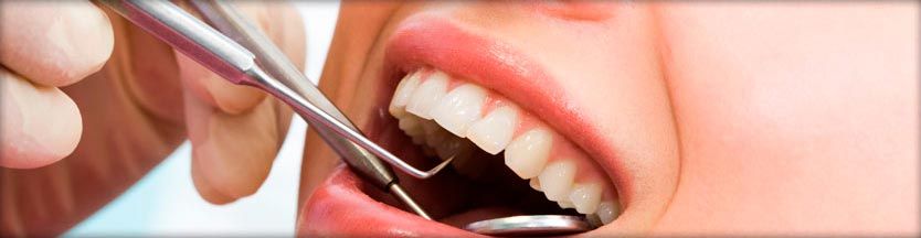 Clínica Dental Austrias dentadura de una mujer